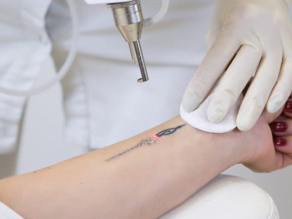 PICO TATTO LEVEL 2